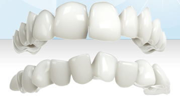 Invisalign Animated Dental Spacing