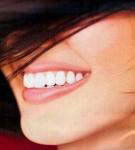 A perfect smile A perfect smile